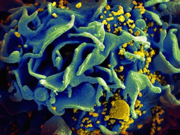 Scientists Report First Cure Of HIV In A Child, Say It's A Game-Changer