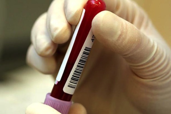 14 Adults 'Functionally Cured' Of HIV